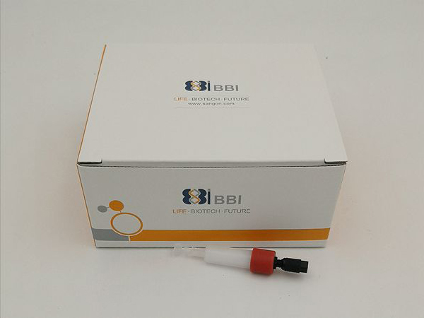 DEAE 预装色谱柱 1X1ML