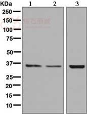 Anti-Aquaporin 8 antibody [EPR8397]  10µl