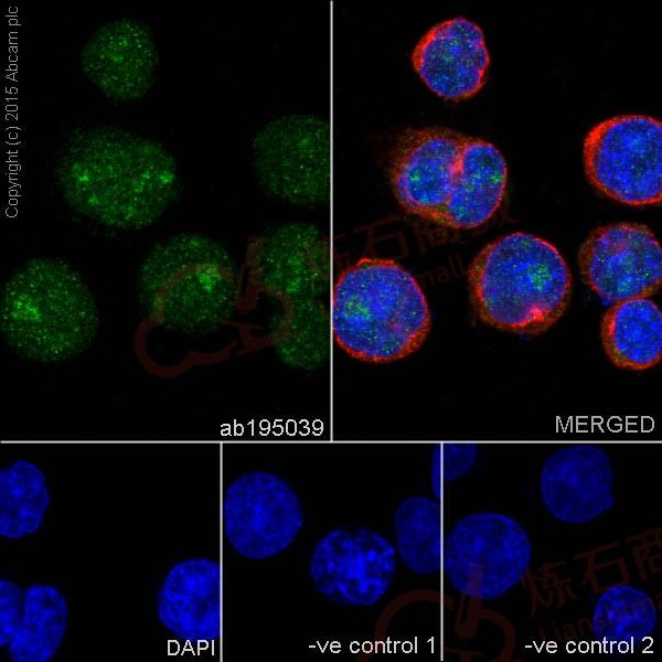 Anti-PKC beta 1 antibody [EPR18512]  10µl