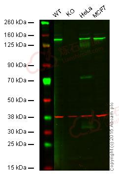Anti-HAUSP / USP7 antibody [EPR4253]  40µl