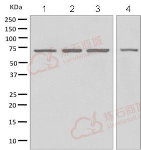 Anti-PGM2 antibody [EPR10393(B)]  40µl