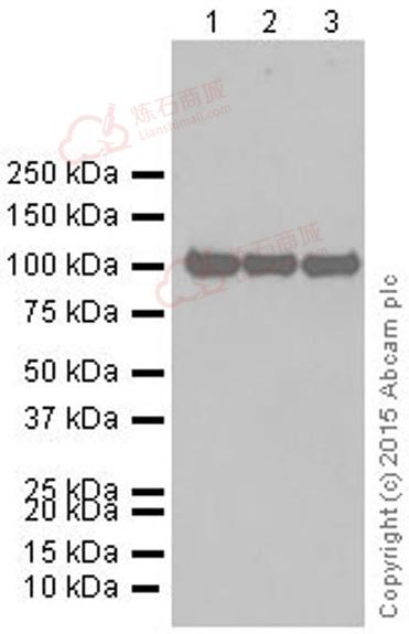 Anti-alpha Actinin antibody [EP2528Y]  10µl