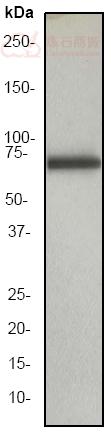 Anti-alpha 1 Fetoprotein antibody [EP1017Y]  10µl