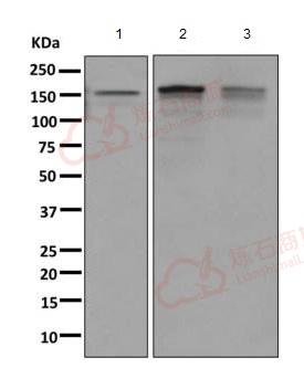 Anti-INPPL1 antibody [EPR10954]  40µl