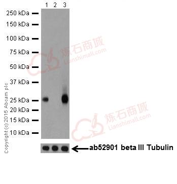 Anti-PHD3 antibody [EPR17869]  10µl