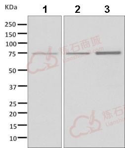 Anti-Apc6 antibody [EPR11168]  100µl