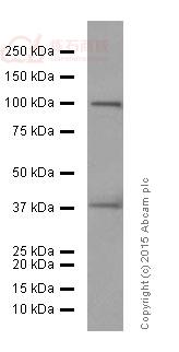 Anti-DUSP6 antibody [EPR129Y]  100µl