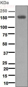 Anti-Desmoglein 1 antibody [EPR6766(B)]  10µl