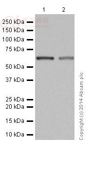 Anti-2 Hydroxy phytanoyl CoA lyase antibody [EPR16812]  40µl