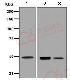 Anti-HGD antibody [EPR7874]  10µl