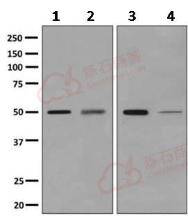 Anti-Adenylosuccinate Lyase antibody [EPR10747(B)]  10µl