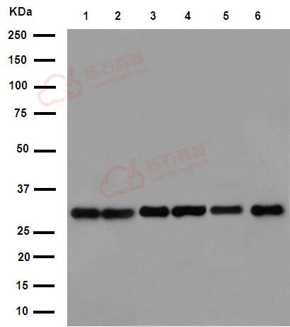 Anti-EXOSC3 antibody [EPR14841] - C-terminal  40µl