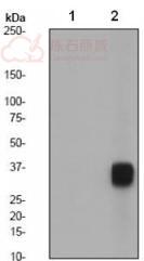 Anti-Nucleophosmin (phospho T199) antibody [EP1857Y]  100µl