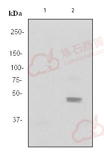 Anti-JNK1+JNK2+JNK3 (phospho Y185 + Y185 + Y223) antibody [EP1597Y]  100µl