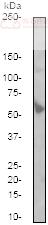 Anti-Mutant p53 antibody [E47]  100µl