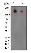 Anti-NMDAR2B (phospho S1303) antibody [EP1858Y]  10µl