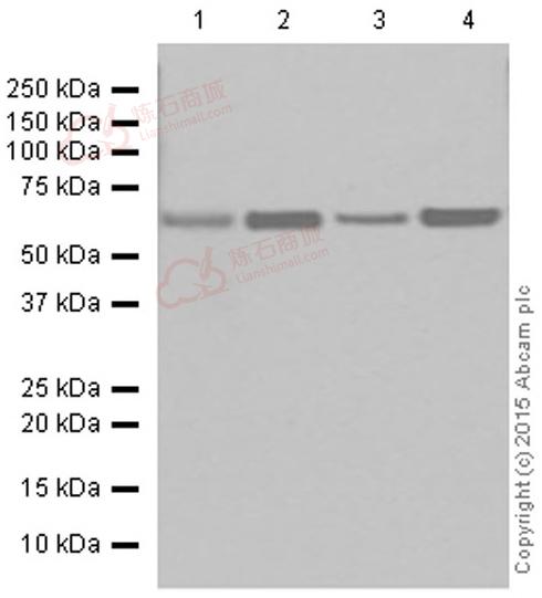 Anti-CPT2 antibody [EPR13626] - C-terminal  10µl