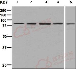 Anti-Methylmalonyl Coenzyme A mutase antibody [EPR7739]  10µl