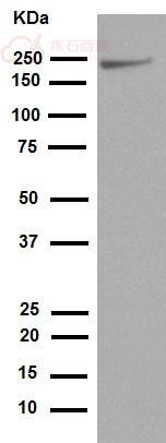 Anti-NSD3 antibody [EPR13813] - N-terminal  100µl