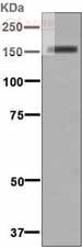 Anti-Desmoglein 1 antibody [EP6765]  100µl