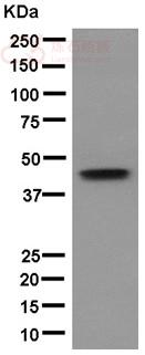 Anti-KRT31 antibody [EPR12849] - N-terminal  40µl