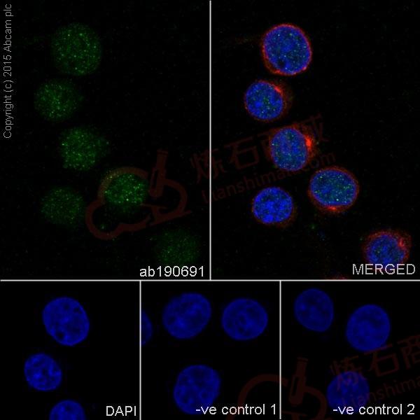 Anti-Ikaros antibody [EPR13791] - C-terminal  100µl