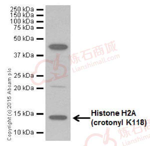 Anti-Histone H2A (crotonyl K118) antibody [EP18768]  40µl