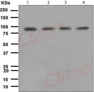 Anti-DDX50 antibody [EPR5273]  100µl