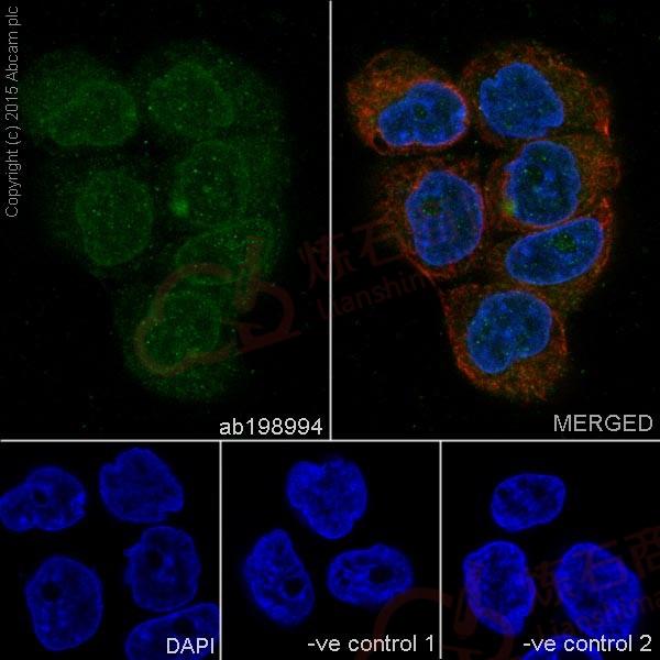 Anti-Loricrin antibody [EPR7149(2)] - C-terminal  10µl