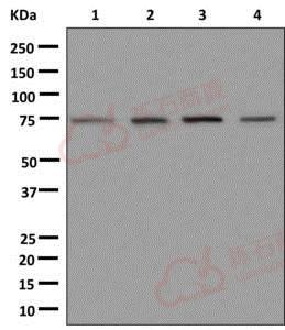 Anti-DHX35 antibody [EPR12383] - C-terminal  100µl