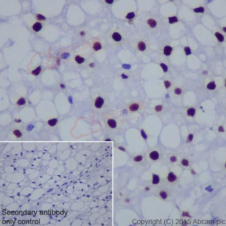 Anti-Brachyury / Bry antibody [EPR18113]  100µl