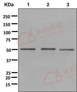 Anti-DYNC1LI2 antibody [EPR11230(2)]  100µl