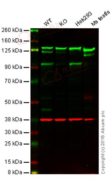 Anti-KMT6 / EZH2 antibody [EPR9307(2)] - N-terminal  10µl