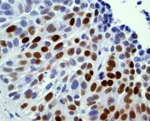 Anti-Mutant p53 antibody [Y5]  40µl