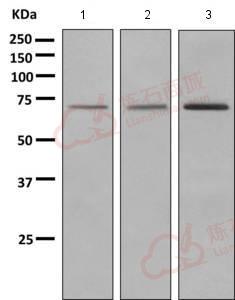 Anti-Guanylyl Cyclase beta 1 antibody [EPR8822]  40µl