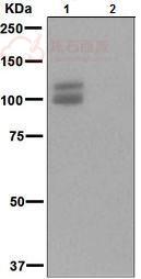 Anti-Amyloid Precursor Protein (phospho T743) antibody [EPR826(2)]  10µl