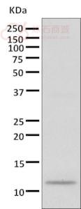 Anti-Dynein light chain antibody [EPR11234]  100µl