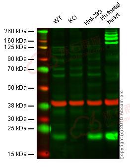 Anti-Ndufs4 antibody [EPR7831]  100µl
