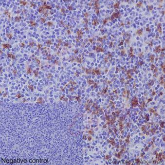 Anti-CD8 alpha antibody [EPR10640(2)] - N-terminal  100µl