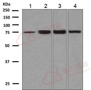 Anti-KBTBD8 antibody [EPR10698(B)]  100µl