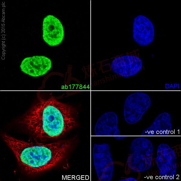 Anti-Histone H4 (crotonyl K5) antibody [EPR17903]  100µl
