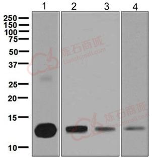 Anti-liver FABP antibody [EPR5895(2)]  40µl