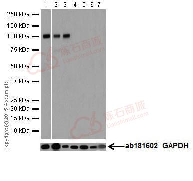 Anti-Ionotropic Glutamate receptor 2 antibody [EPR18115]  10µl