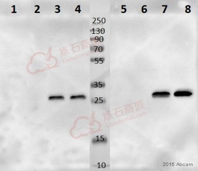 Anti-NDUFS3 antibody [EPR12782] - C-terminal  100µl