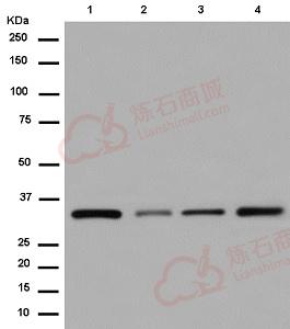 Anti-COPE antibody [EPR12579]  40µl