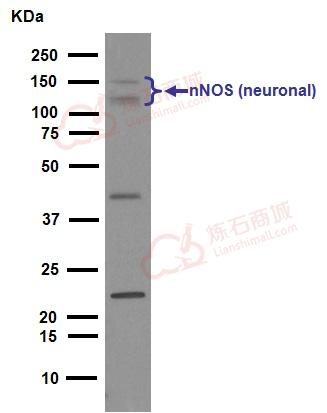 Anti-nNOS (neuronal) antibody [EP1855Y]  10µl