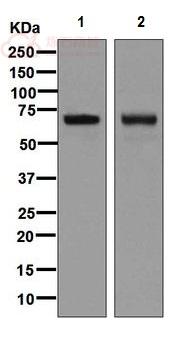 Anti-alpha 1 Fetoprotein antibody [EPAFP61]  100µl