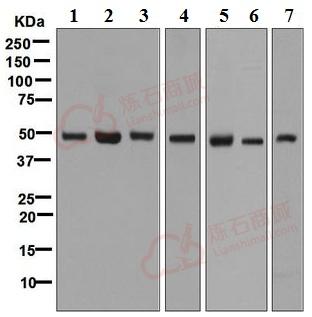 Anti-eIF3e antibody [EPR6877]  10µl