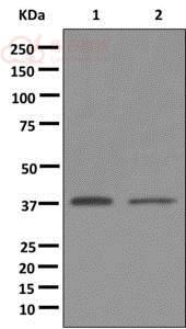 Anti-GPCR GPR18 antibody [EPR12359]  100µl