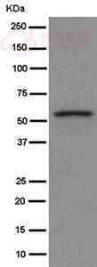 Anti-Hydrogen Potassium ATPase Beta antibody [EPR8819(2)] - C-terminal  40µl